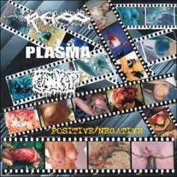 Plasma (GER) : Positive-Negative